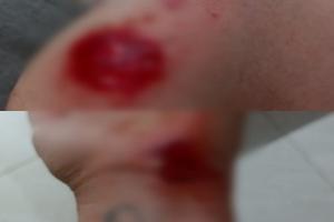 Estudiantes de enfermería fueron atracadas por los de la ‘RX’ en la 42 con 5ª en Ibagué