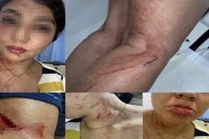 “Mi expareja y su familia me cogieron a machete, puñal y golpes en Picaleña”: Michel Medina