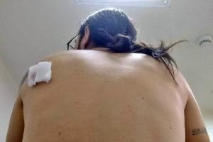 Apuñalaron a ciclista para despojarlo de su bicicleta sobre la Guabinal de Ibagué