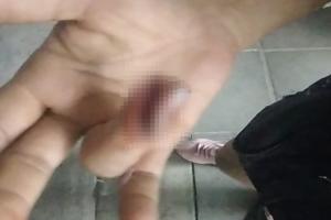 Batalla campal entre dos familias en el barrio Nuevo Combeima