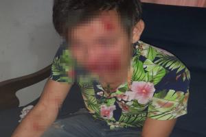 Agredieron brutalmente a ‘Tavo’ por robarle el celular entre Villa del Sol y Nuevo Armero