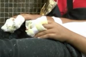 Adolescente que se quemó los genitales con pólvora en Palocabildo 