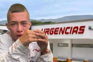 Ladrón Pitalito