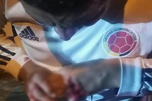 Casi pierde sus dedos por machetazo