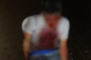 Sujeto invitó a un vecino a tomarse unos tragos y lo cogió a machete en el barrio Nueva Castilla de Ibagué