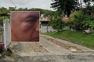 Hombre golpeado barrio Topacio