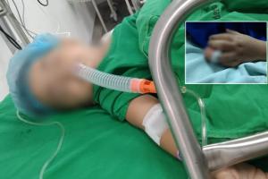 Niña de 3 años fue mordida por Bulldog en Las Ferias y su dueño no responde por la reconstrucción del dedito de la pequeña