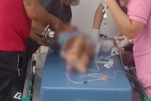 A niña de 8 años le quedó mano atrapada en molino eléctrico en la vereda Cay de Ibagué