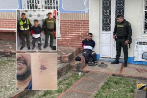 Ciudadano de talla baja, se ‘salió de los chiros’, mordiendo y cogiendo a piedra a Inspector de Policía}