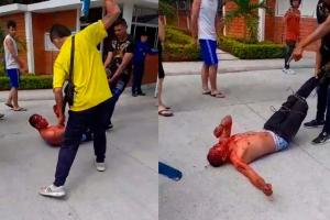 Presunto ladrón recibió palo terapia en Neiva, Huila