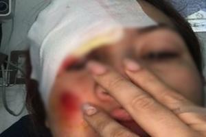 Una motociclista fue arrollada por un particular en el Jardín Santander y el conductor huyó sin auxiliarla