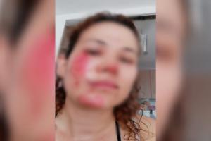 Sujetos hicieron accidentar a una mujer por robarla en inmediaciones de la variante Del Rodeo