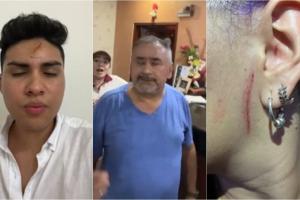 Indignación familiar tras presunta agresión de empleados del hotel Anamichu de Melgar