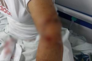 Riña dejó lesionada a presidenta de Junta del barrio Territorio de Paz en Ibagué