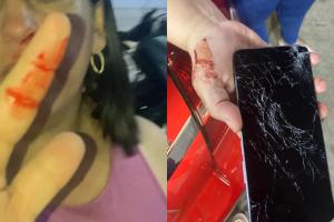 Denuncian presunta agresión de tripulación de ambulancia en el sur de Ibagué