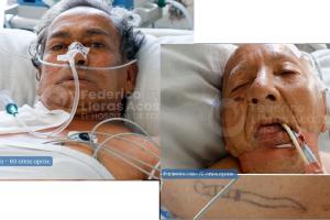 Pacientes N.N. Federico Lleras