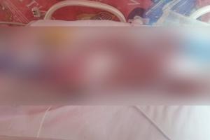 Bebé fallecido en Ibagué