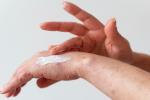 Dermatitis